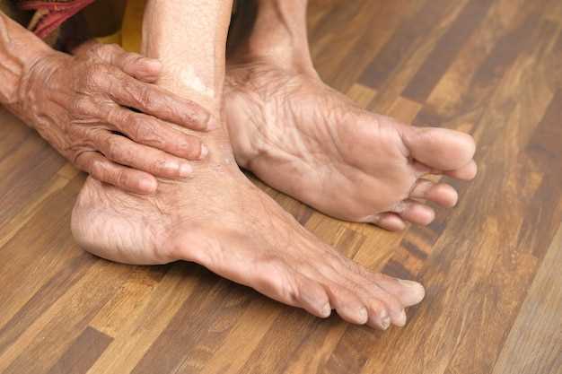 Causes of numbness in hands and feet