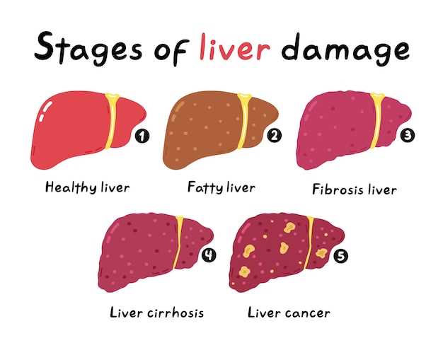 Potential Liver Damage from Lisinopril