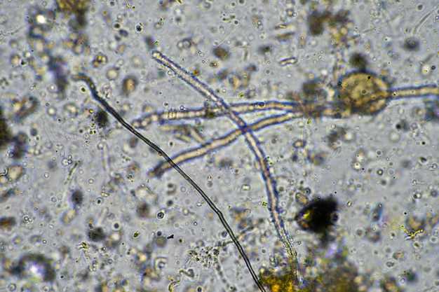 Biological half life of lisinopril
