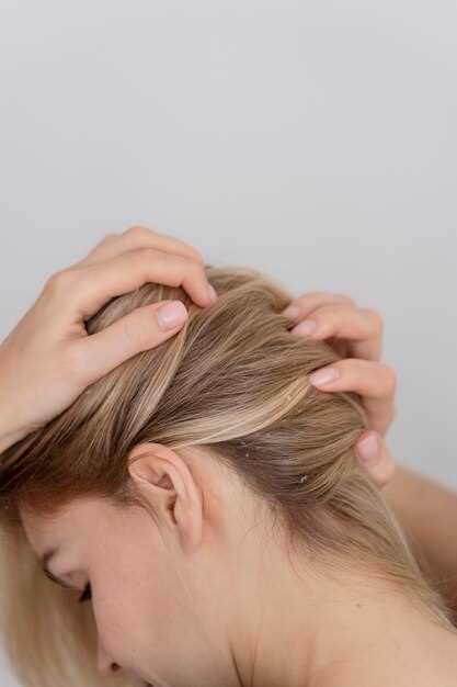 Hair loss associated with lisinopril