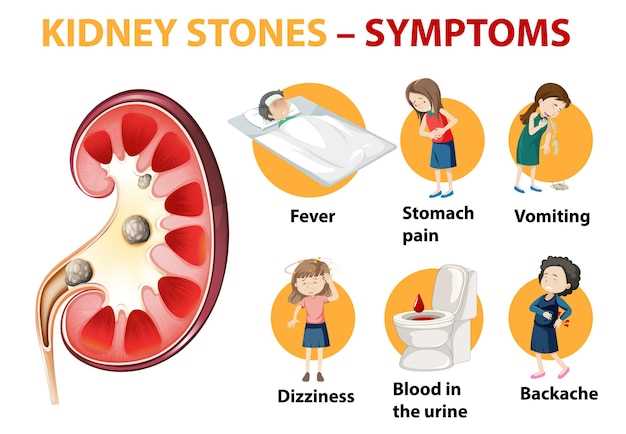 Lisinopril cause kidney stones