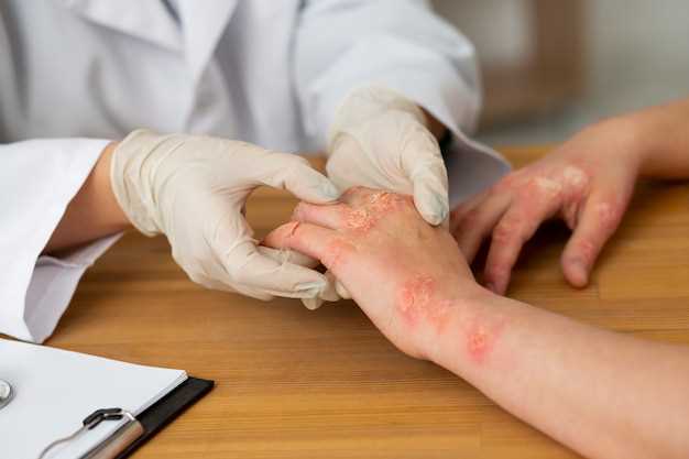 Lisinopril rash treatment